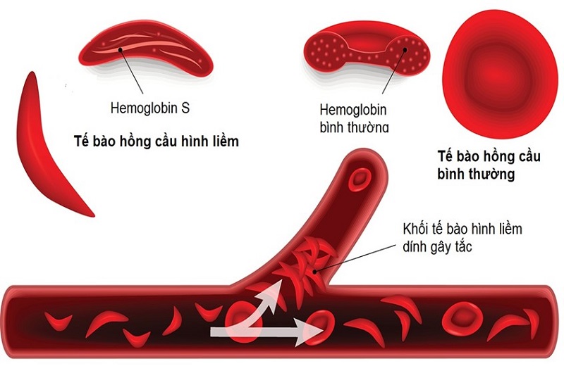 Tương Tác Gen Là Gì? Quy Luật Tương Tác Và Tính Đa Hiệu Của Gen