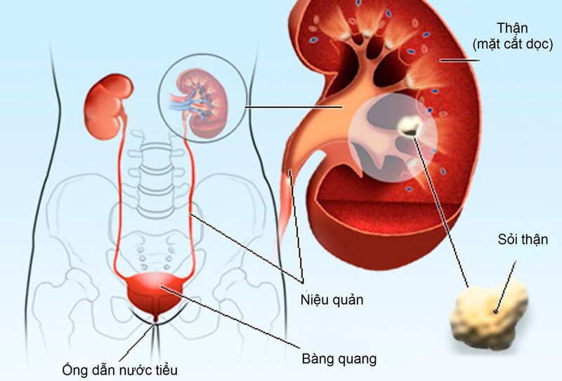 Ý nghĩa chỉ số pH nước tiểu là gì?