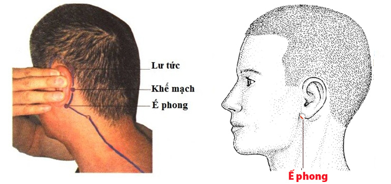 Huyệt Ế Phong Nằm Ở Đâu? Tìm Hiểu Cách Khai Thông Trị Bệnh