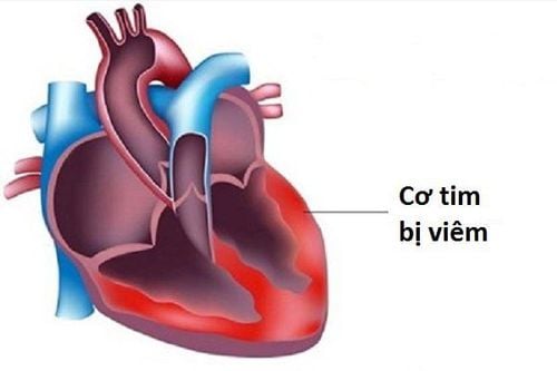 Vi khuẩn gram dương là gì?