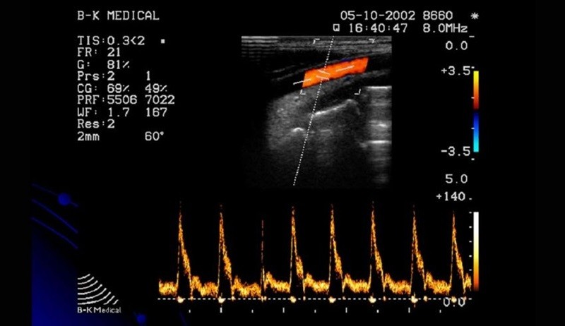 Hiệu ứng Doppler: Khái niệm, Nguyên lý và Ứng dụng thực tiễn